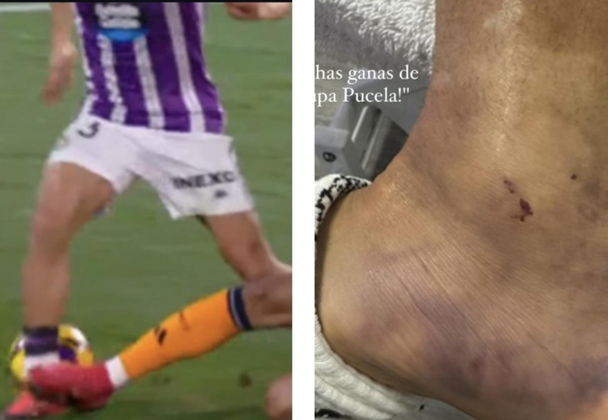 Entrada de Mbappé sobre Anuar y sus consecuencias