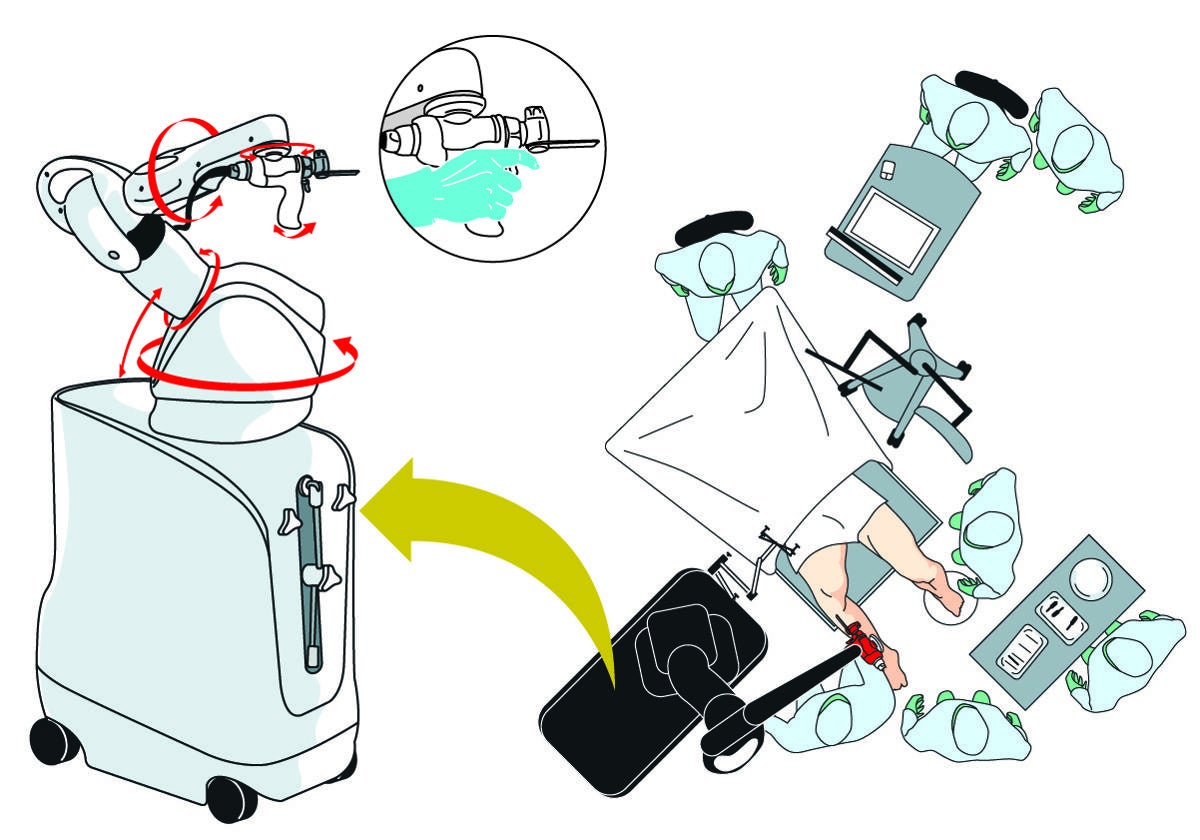 Así funciona el robot Mako con el que operan traumatólogos del Hospital Clínico