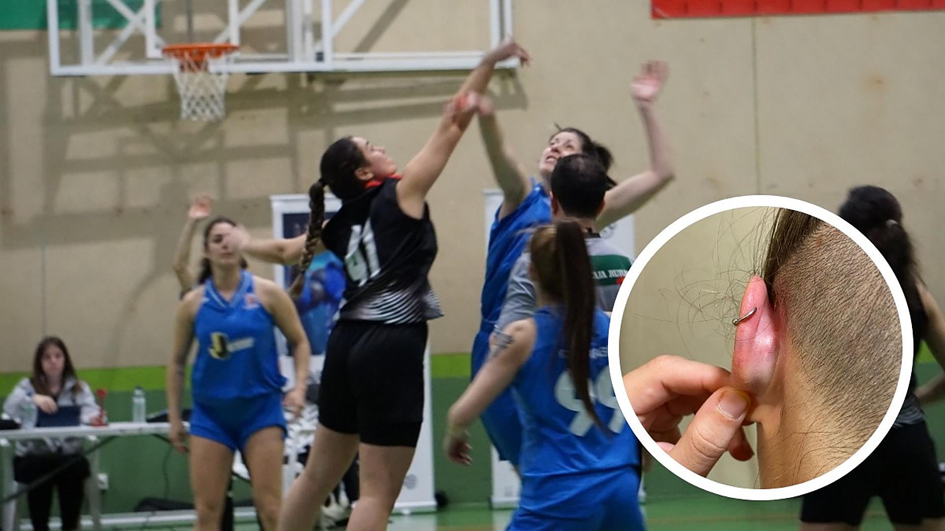 Valladolid Basketball: Assault After Women’s Game