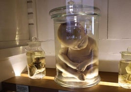 El feto de 8 meses que murió de hidrocefalia y que se conserva en parafina en el interior del Museo de Ciencias Naturales de Valladolid