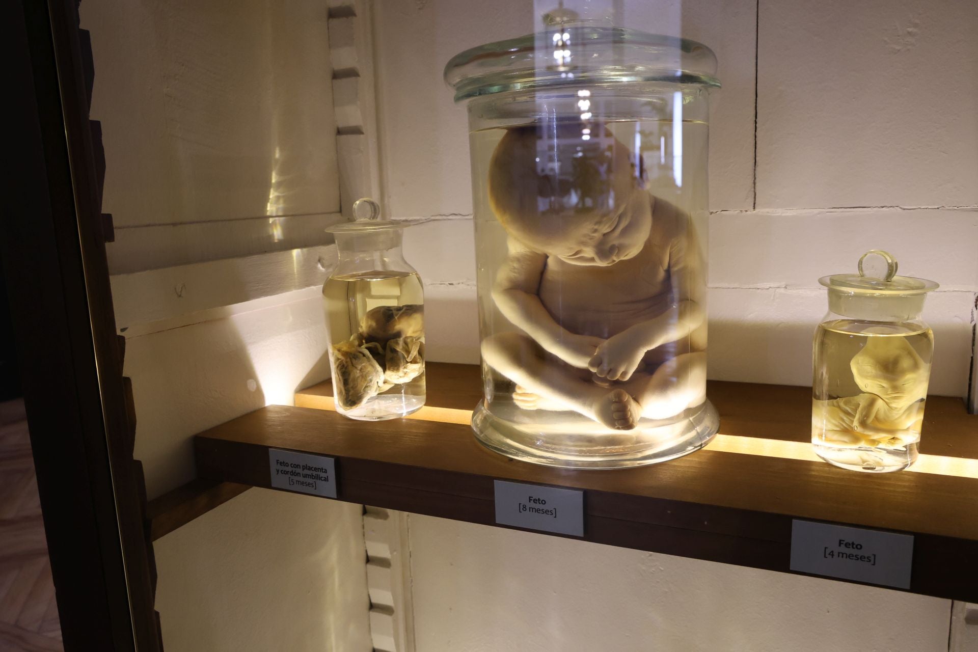 El feto de 8 meses que murió de hidrocefalia y que se conserva en parafina en el interior del Museo de Ciencias Naturales de Valladolid