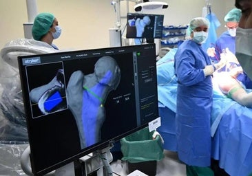 Deniegan a una palentina elegir hospital para operarse en el Clínico con el robot Mako