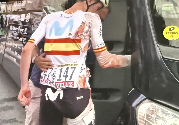 Iván Romeo sufrió una dura caída en la etapa 20 del Tour de Francia.