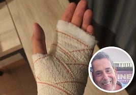 La lesión de Aurelio Mata Padilla, aficionado del Ceuta.