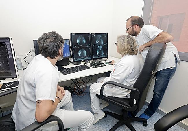 Radiólogos de la Unidad de Mama del Hospital Universitario Río Hortega valoran una mamografía.