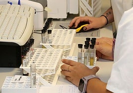 Personal sanitario recoge muestras de análisis en el laboratorio del Hospital de Segovia.