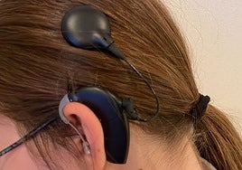 ¿Qué pasó con el implante coclear que perdió Julia?: La familia de la niña pide ayuda al hospital