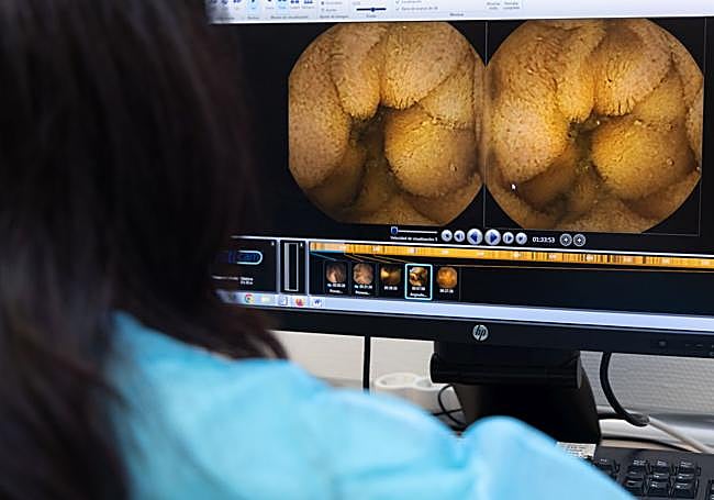 Imágenes remitidas por la cápsula del intestino de un paciente.