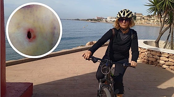 Dos mastines «enormes» atacan a una ciclista en Torrescárcela: «Fue como una película de terror»