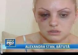 Alexandra Stan, brutalmente golpeada por su novio