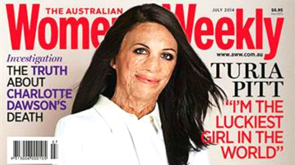 Una joven con la cara quemada, portada de una revista de moda