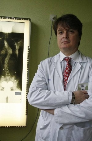 Estévez, en su consulta con una radiografía de escoliosis. ::
G. VILLAMIL