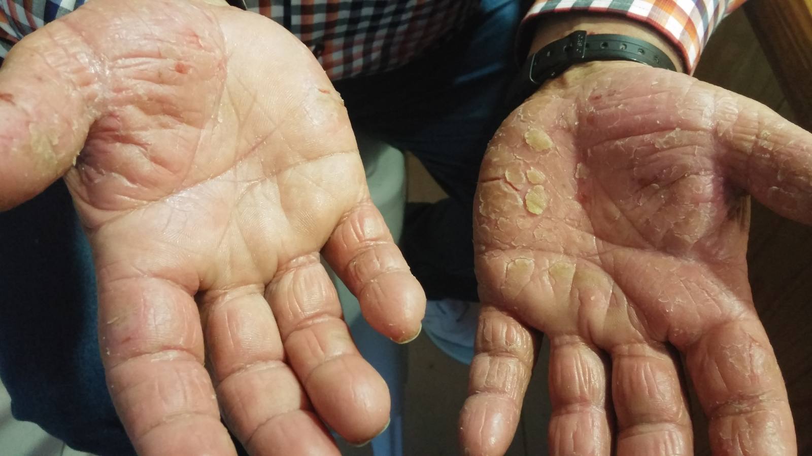 Un vecino reclama especialista dermatólogo para la zona de salud de Mérida
