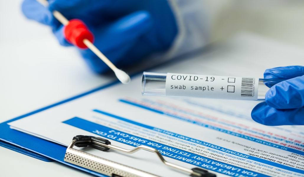 El centro de salud Apolinar Moreno continúa haciendo PCR a diario 