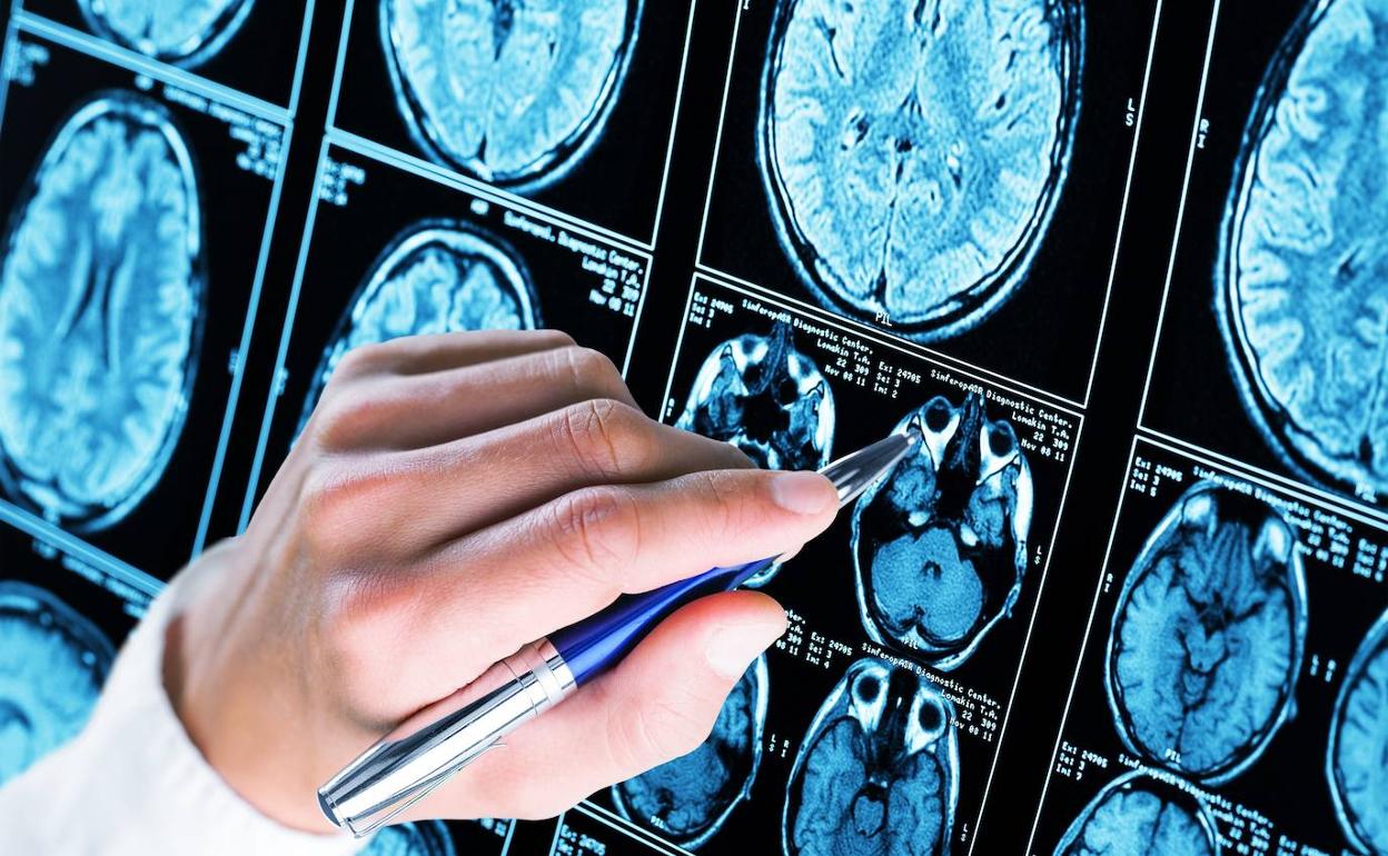 Afaex organiza durante septiembre y octubre actividades con motivo del Día Mundial del Alzheimer