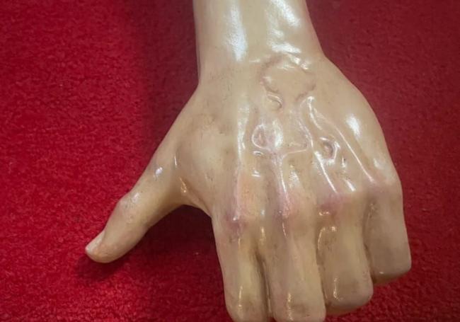 Estado tras la restauración