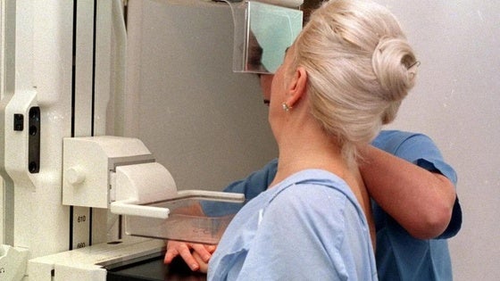 Más de 7.700 extremeñas tienen cita este mes para una mamografía