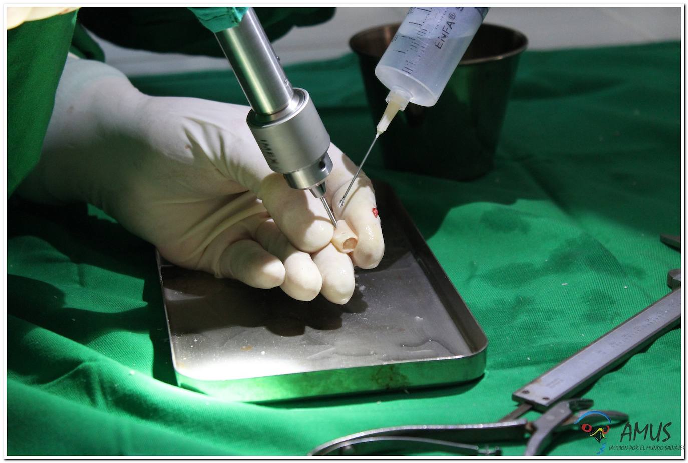 Operacion del Milano real 