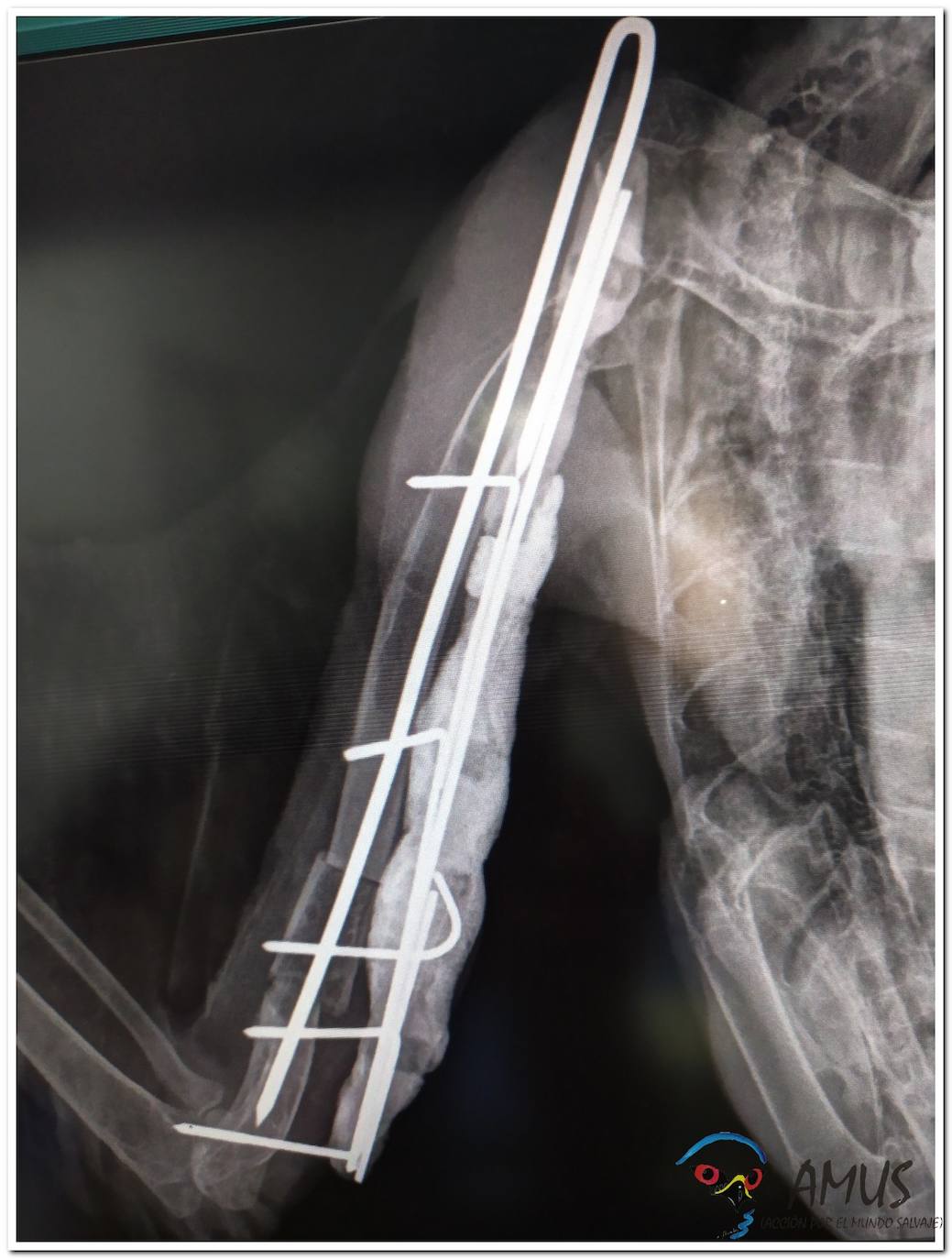 Operacion del Milano real 