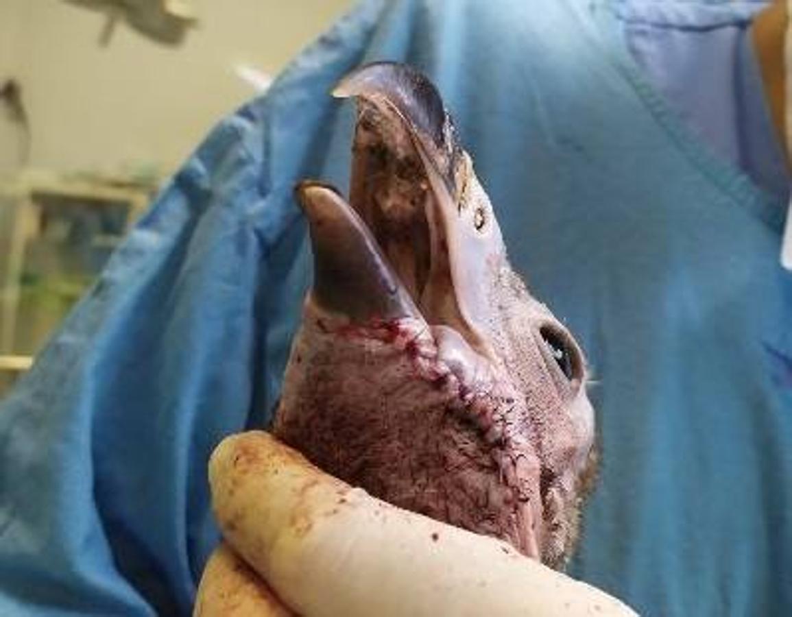 Instante postquirúrgico en donde se aprecia la angulación y la forma anatómica correcta creada.