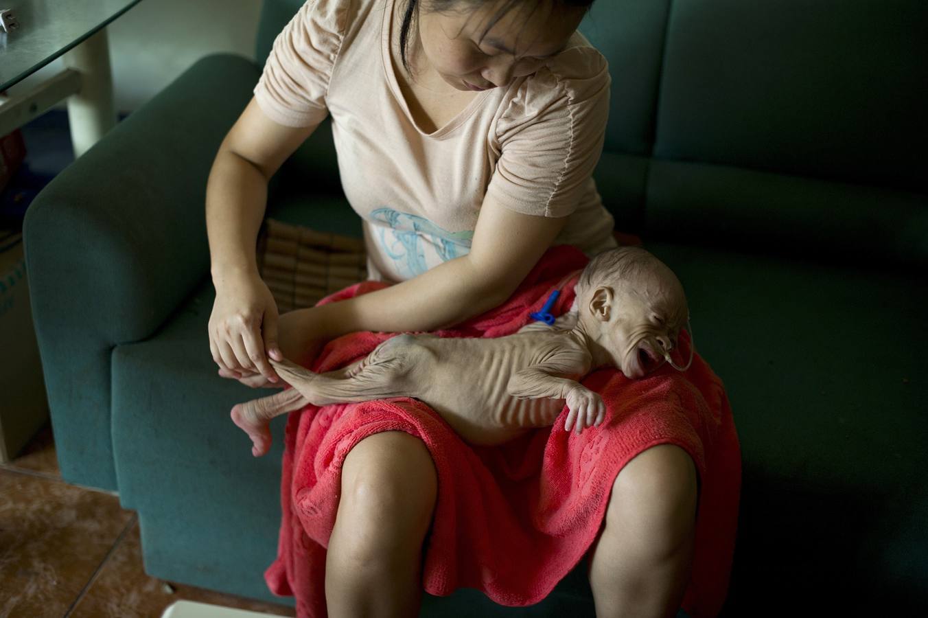 Lunes 1 de septiembre: Wu Lunjiao sostiene a su hija Yuanyuan, que sufre de una enfermedad desconocida, en Shenzhen, provincia de Guangdong. Yuanyuan, que pesa 2,5 kg solo ha aumentado 0,05 kg desde que nació hace 13 meses. A pesar de que la familia ya ha pagado 12,400 euros para conseguir un informe médico de los hospitales de Shenzhen, Guangzhou y Beijin que indique el mal que aqueja a la niña, pero aún se desconoce la enfermedad. REUTERS / Stringer