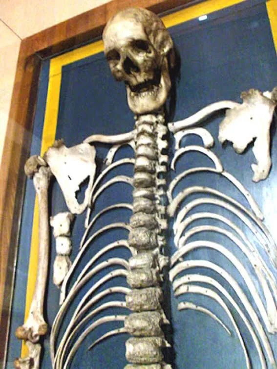 8-El esqueleto de Agustín Luengo que está expuesto en el Museo Nacional de Antropología de Madrid.
