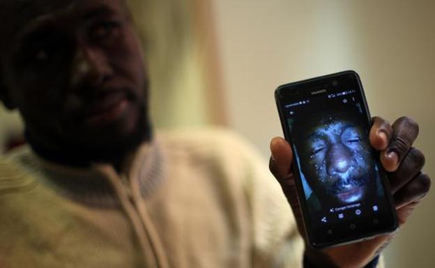 SANADO. Abou estaba muy enfermo cuando lo salvó el Aquarius. Una foto en su móvil con su rostro llagado le recuerda la amargura de aquellos días. Pasó dos meses en el hospital.