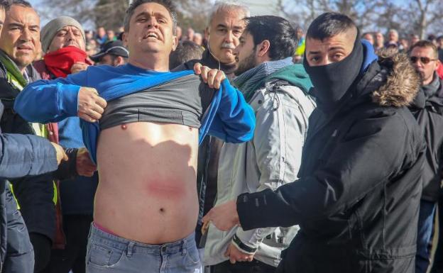 Un taxista muestra los moratones tras las cargas de la policía en el entorno de Ifema 