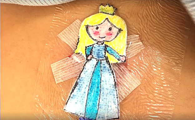 Imagen principal - Distintos apósitos ilustrados por el doctor Parry.