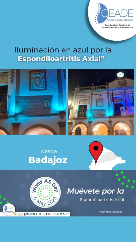 En ciudades como Badajoz se ha visibilizado esta enfermedad iluminando de azul edificios públicos.