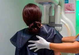 Casi 5.000 extremeñas se harán mamografías en diciembre