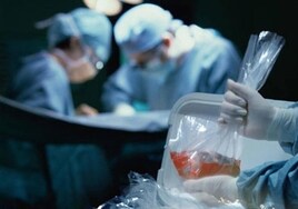 Personal médico durante una operación de trasplante.