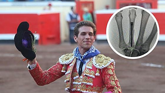 Ginés Marín se lesiona la mano izquierda tras un percance cuando toreaba en México
