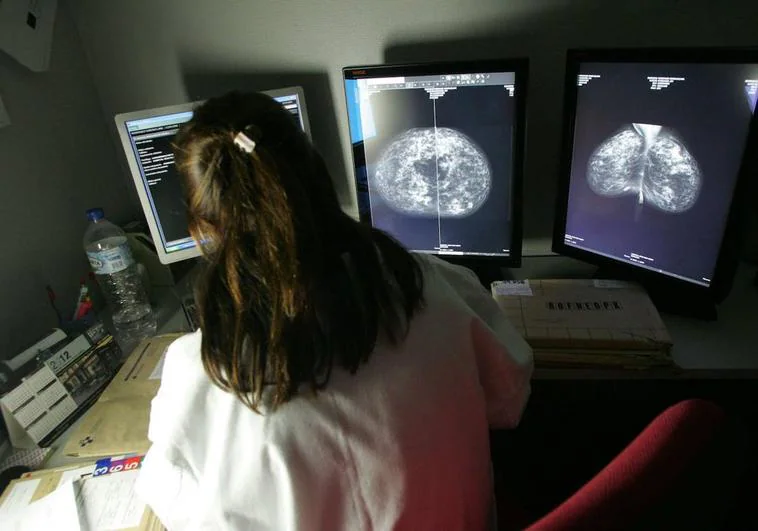 Más de 8.000 extremeñas se harán mamografías en abril para la detección del cáncer