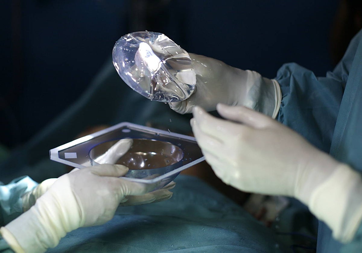 Imagen de archivo de una prótesis mamaria.