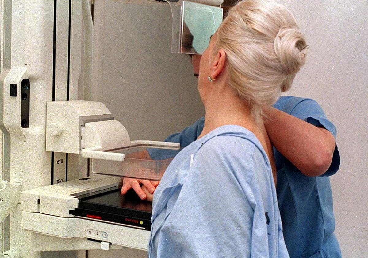 Imagen de archivo de la realización de una mamografía.