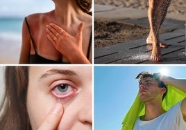Las 11 enfermedades más comunes del verano: causas y cómo prevenirlas