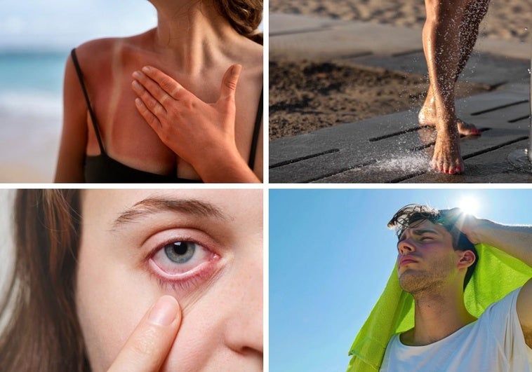 Las 11 enfermedades más comunes del verano: causas y cómo prevenirlas