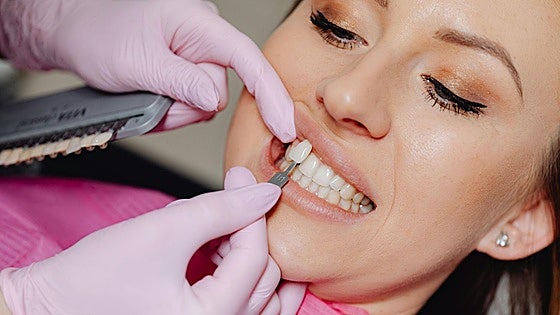 Dentistas alertan: el peligro del auge del 'turismo dental' en Marruecos