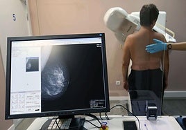 Imagen de archivo de una mujer realizándose una mamografía.
