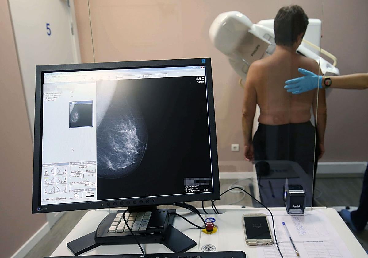 Imagen de archivo de una mujer realizándose una mamografía.