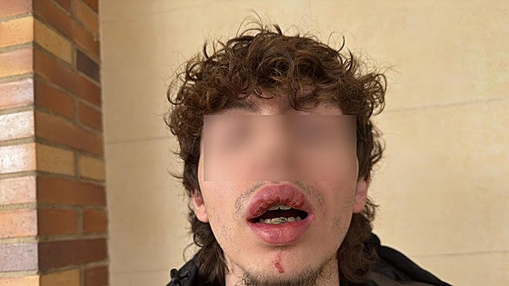 Badajoz busca a la conductora que atropelló a un joven en patinete
