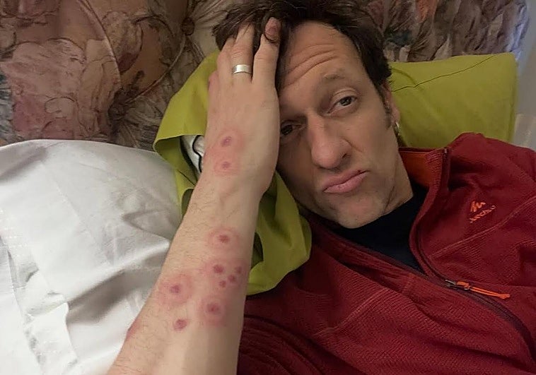 Edu Soto agradece el trato recibido en el hospital de Mérida: «Una semana de picores inimaginables»