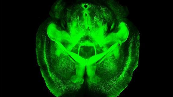 Representación tridimensional del cerebro