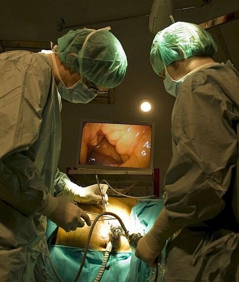 Médicos realizando un trasplante renal. 