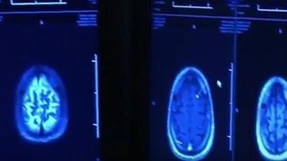 Va al médico por un dolor de cabeza y descubre que le queda media hora de vida