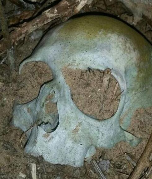 Imagen referencial de un cráneo semi-enterrado.
