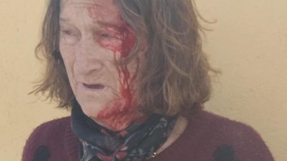 Agreden a una anciana en la puerta de su casa de Balerma para robarle el bolso