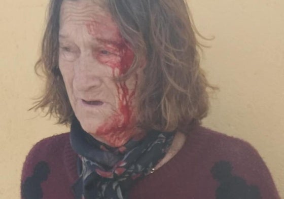 La víctima, tras la agresión recibida.