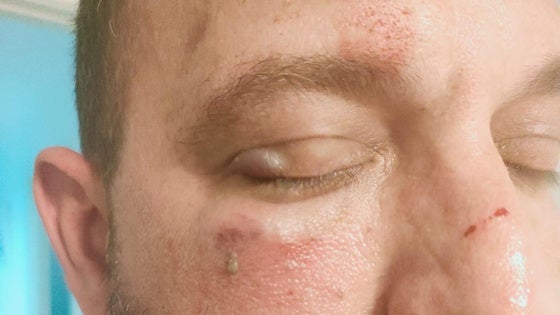 Fractura de mandíbula, lesiones y amenazas: un detenido por agredir a un guardia civil fuera de servicio en Roquetas